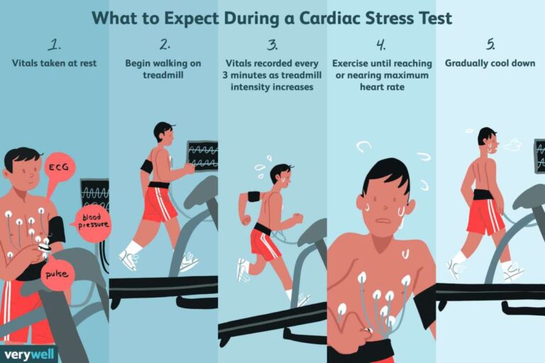 What Happens During A Treadmill Stress Test